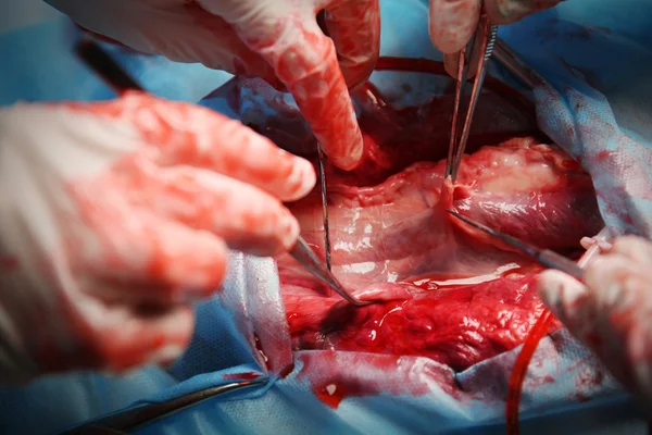 Doktor dělá srdce operace — Stock fotografie