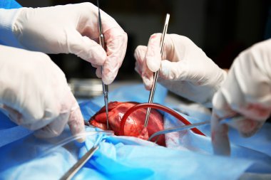 Doktor kalp işlem yapmadan