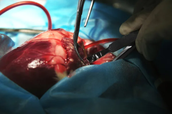 Heart operation closeup — Stock Photo, Image