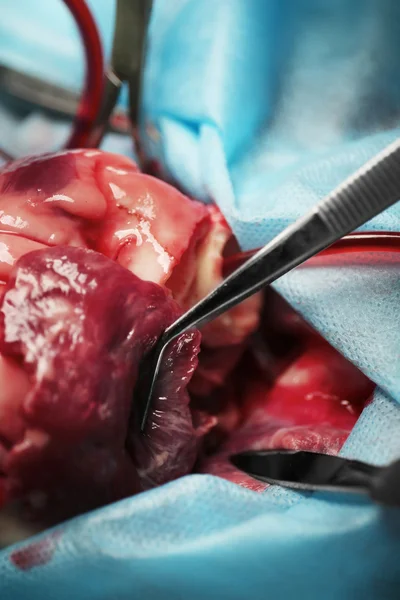 Heart operation closeup — Stock Photo, Image