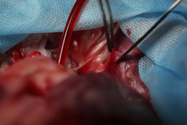 Heart operation closeup — Stock Photo, Image
