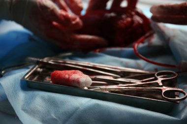Doktor kalp işlem yapmadan