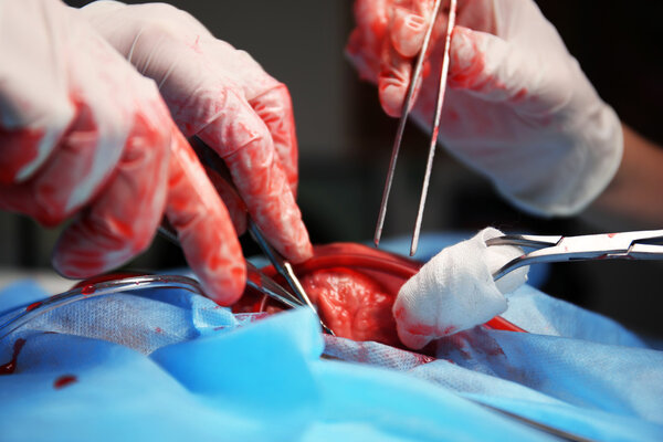 Doctor doing heart operation