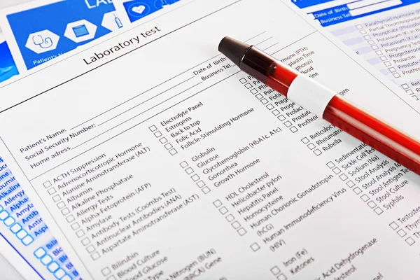 Blood in test tube — Stock Photo, Image