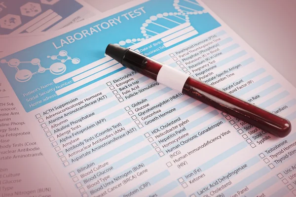 Blood in test tube — Stock Photo, Image