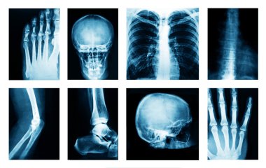 Collage of many X-rays clipart