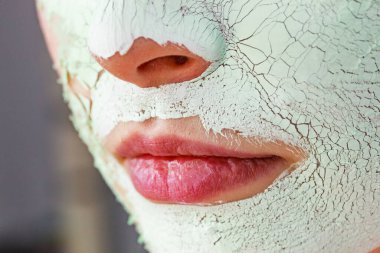 Yüzünde yeşil, beyaz çamur maskesi olan kadın, detay görünümlü. Genç kızın cildinde kuru çatlak kozmetik var. Güzellik tedavisi. Cilt bakımı.