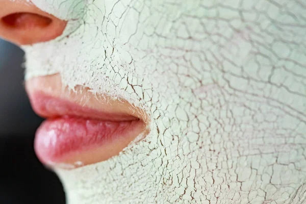 Close Woman Green White Mud Mask Face Detail View Teen — Stock Photo, Image