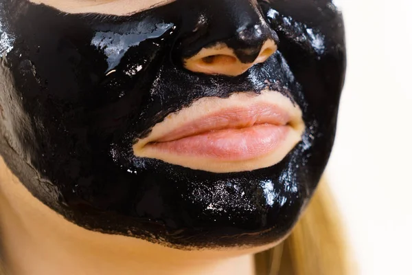 Jonge Vrouw Met Cosmetische Het Gezicht Carbo Detox Zwarte Peel — Stockfoto