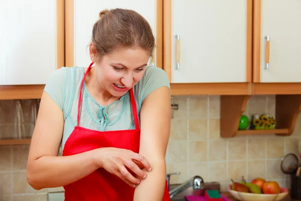 Donna che gratta il braccio pruriginoso. Allergia . — Foto Stock