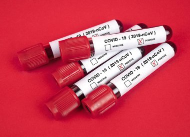 Coronavirus 2019-nCoV kan örneklerini kırmızı arka planda test et