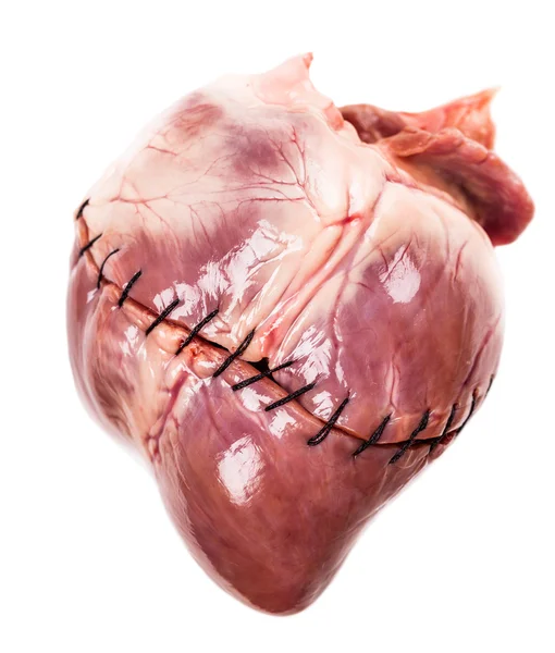 Heart with suture close-up — Stock Photo, Image