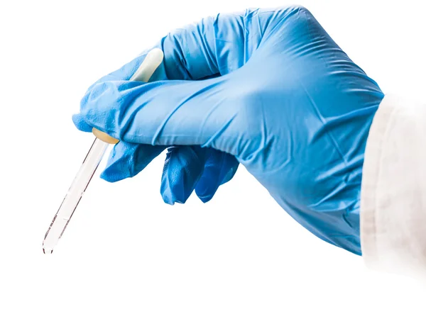 Pipette in hand employee — Stock Photo, Image