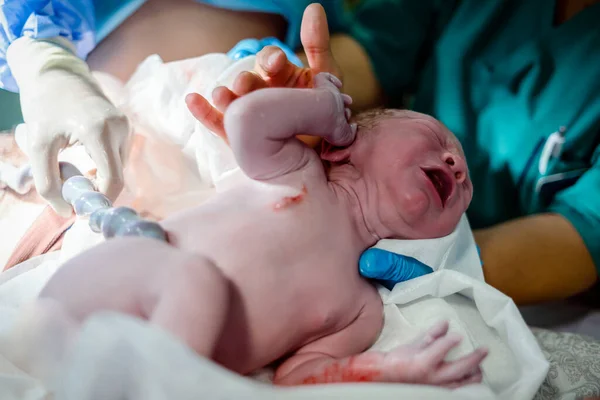 Neugeborener Junge Noch Mit Nabelschnur Die Ihn Mit Mutter Verbindet — Stockfoto