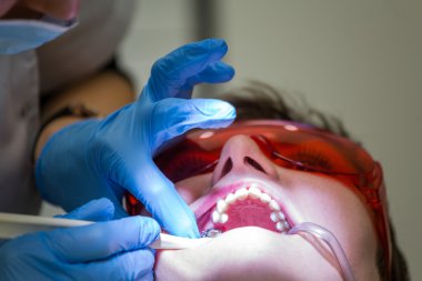 Diş diş teli almak