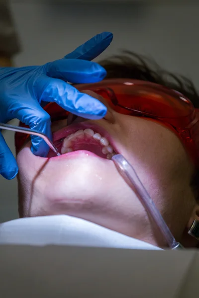 Paciente en el consultorio del dentista - trabajo real . —  Fotos de Stock