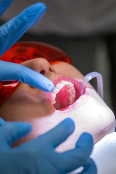Paziente nello studio dentistico - lavoro reale . — Foto Stock
