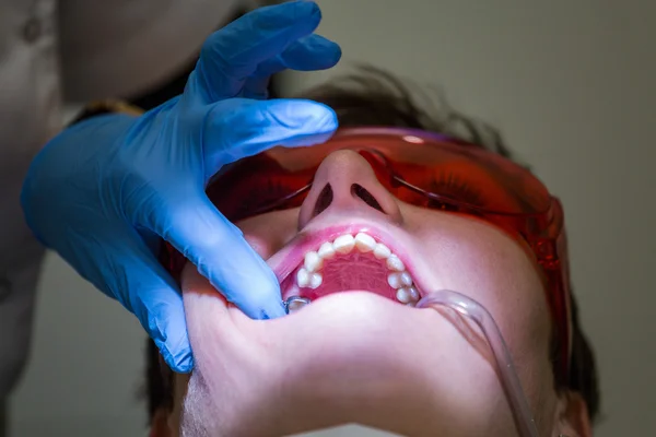 Att få tandställning på tänder — Stockfoto
