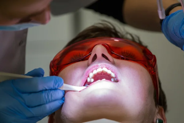 Ficando aparelhos nos dentes — Fotografia de Stock