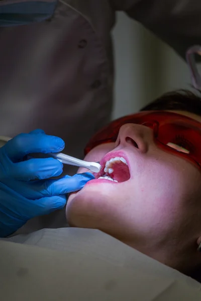 Conseguir aparatos ortopédicos en dientes — Foto de Stock