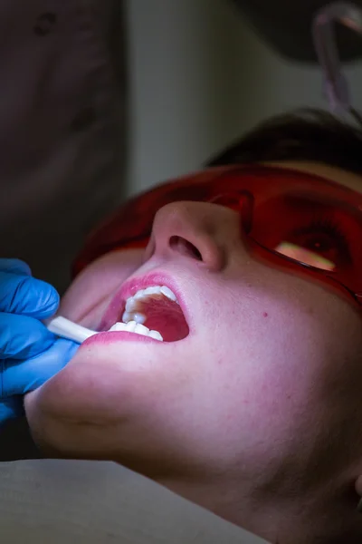 Ficando aparelhos nos dentes — Fotografia de Stock