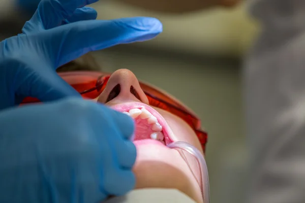 Conseguir aparatos ortopédicos en dientes — Foto de Stock