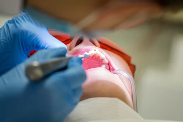 Ficando aparelhos nos dentes — Fotografia de Stock