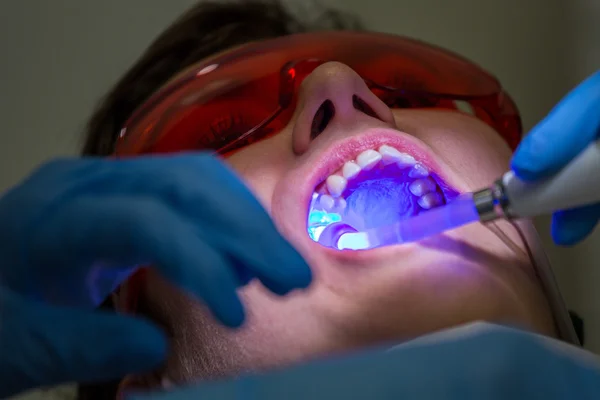 Получение брекетов на зубах — стоковое фото