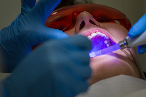Conseguir aparatos ortopédicos en dientes — Foto de Stock