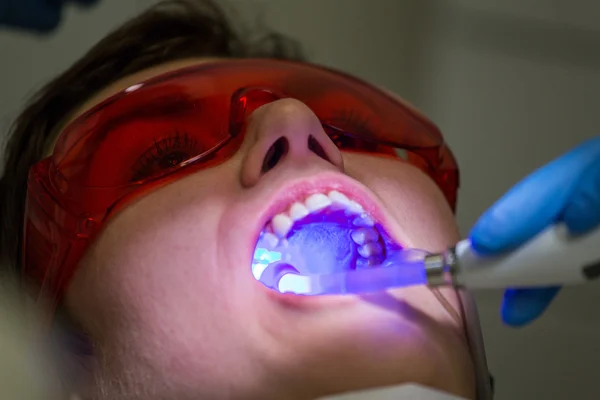 Ficando aparelhos nos dentes — Fotografia de Stock