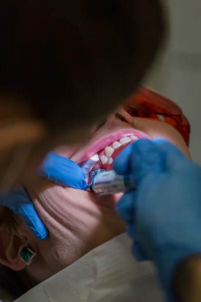 Ficando aparelhos nos dentes — Fotografia de Stock