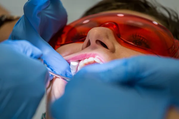 Ficando aparelhos nos dentes — Fotografia de Stock