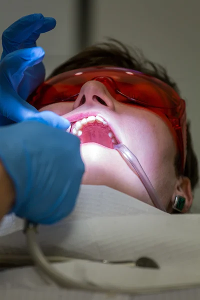 Ficando aparelhos nos dentes — Fotografia de Stock