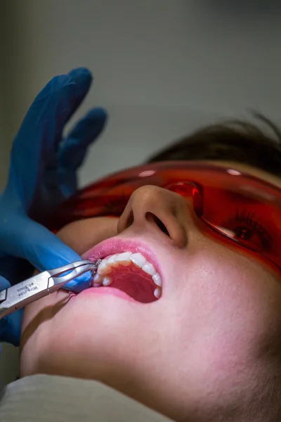 Conseguir aparatos ortopédicos en dientes —  Fotos de Stock
