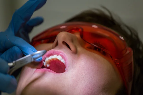 Ficando aparelhos nos dentes — Fotografia de Stock