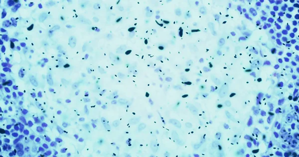 彩色化学蓝色流体中的显微镜下的细菌或细菌微生物细胞 — 图库照片