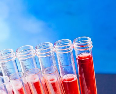 Kırmızı sıvı laboratuarda test tüplerini closeup 