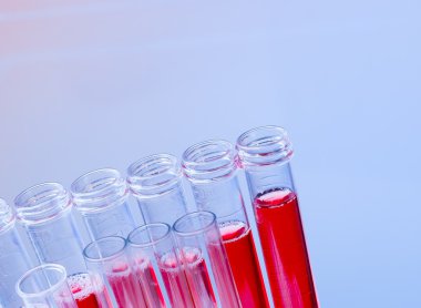 Kırmızı sıvı laboratuarda test tüplerini closeup 