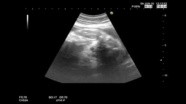 Hochwertige Ultraschall-Echographie-Untersuchung. gynäkologische Untersuchung. 33 Wochen Schwangerschaft — Stockvideo