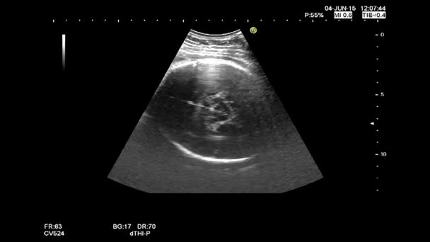 Hochwertige Ultraschall-Echographie-Untersuchung. gynäkologische Untersuchung. 33 Wochen alte Schwangerschaft mit geschätzter Größe des Fötus-Checks — Stockvideo