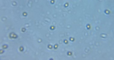 Protozoa amiplerinin ve kemirgenlerin tatlı su örneğindeki gerçek hareketlerini gösteren yüksek büyütme videosu. Sınıf laboratuarı ve eğitim için mükemmel.