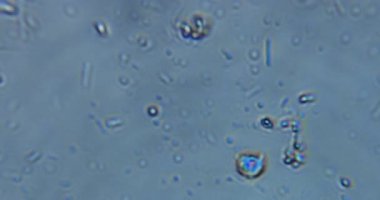 Göl suyunda yaşayan mikroorganizmaların mikroskobik görüntüleri protozoa, rotifer, ciliat ve mikrofaunanın gerçek zamanlı hareketlerini yüksek büyütme altında gösteriyor. Biyoloji eğitimi ve bilim için ideal