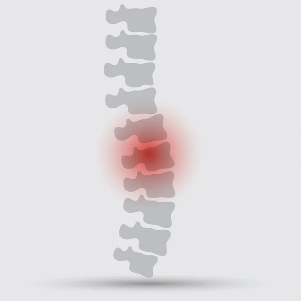 Design do símbolo de diagnóstico da coluna vertebral —  Vetores de Stock