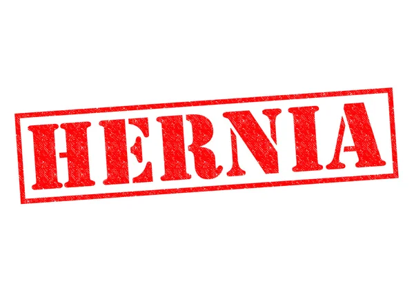 Hernia — Stockfoto