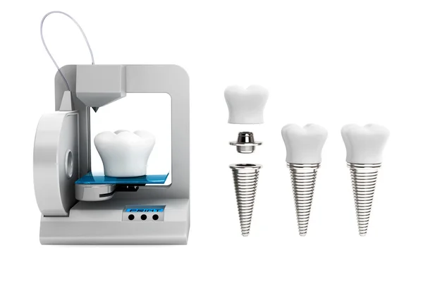 歯科技術コンセプト。3 d プリンター印刷歯インプラントします。 — ストック写真