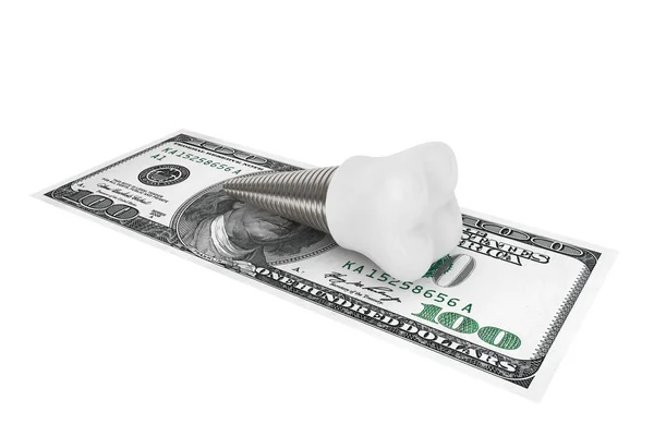 Kosten des zahnärztlichen Konzepts. Zahnimplantat mit Geld — Stockfoto