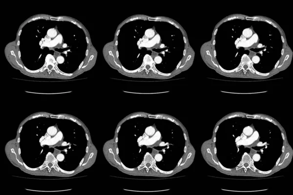 Scan Komputertomográfia Egész Has Kontraszttal Komputertomográfia Egész Has Axiális Második — Stock Fotó