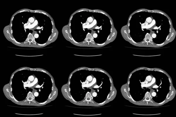 Scan Komputertomográfia Egész Has Kontraszttal Komputertomográfia Egész Has Axiális Harmadik — Stock Fotó