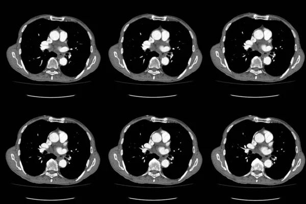 Scan Computertomografie Van Hele Buik Met Contrast Computertomografie Hele Buik — Stockfoto