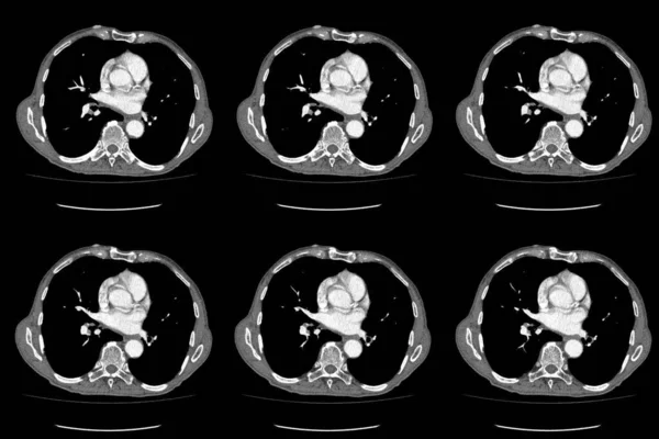 Scan Computertomografie Van Hele Buik Met Contrast Computertomografie Hele Buik — Stockfoto